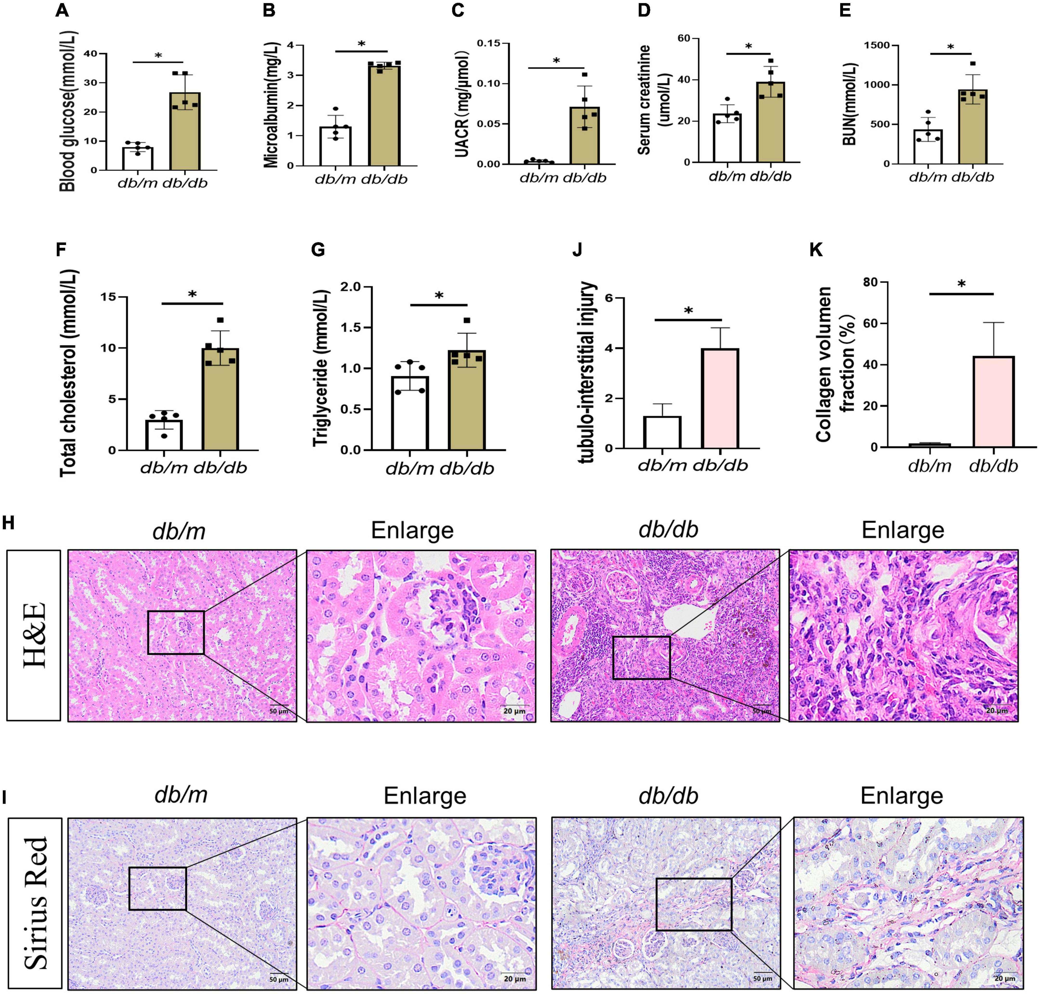 Senescent renal tubular epithelial cells activate fibroblasts by secreting Shh to promote the progression of diabetic kidney disease